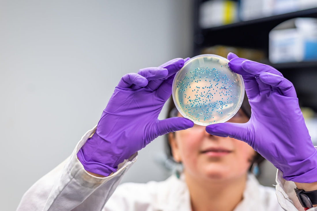 female scientist holding a petri dish in purple gloves – research on saccharomyces boulardii and candida balance